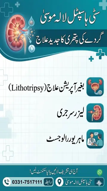 Kidney stone treatment without operation (Urdu poster)